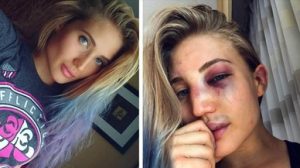 A competidora do Bellator Anastasia Yankova antes e depois da sua última luta